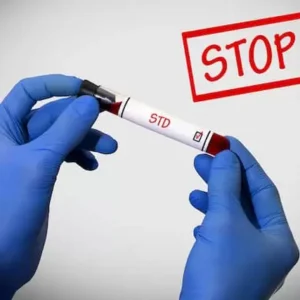 Std Testing Techniques You Should Know About